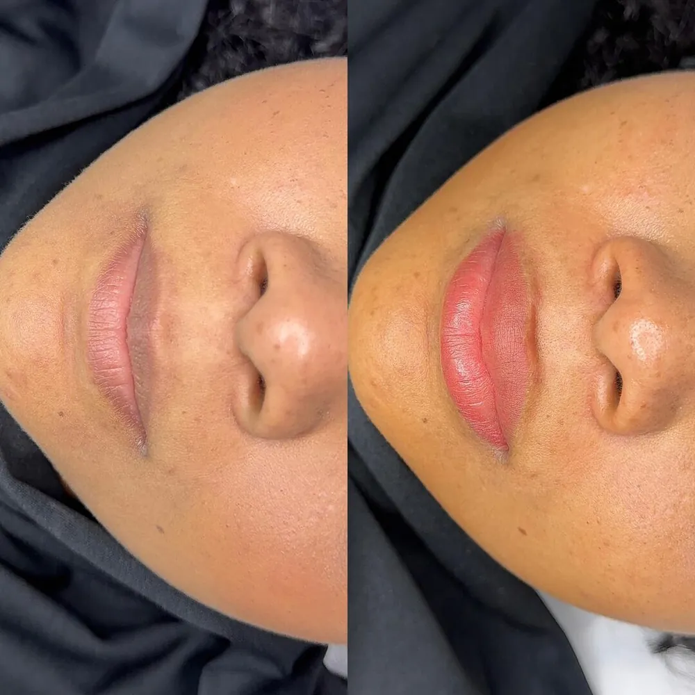 Antes e depois de labial, cor e contorno na Ana Paula Estética