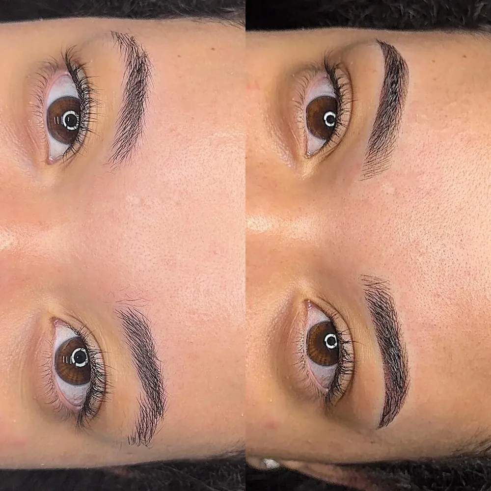 Antes e depois de fio a fio, desenho natural na Ana Paula Estética